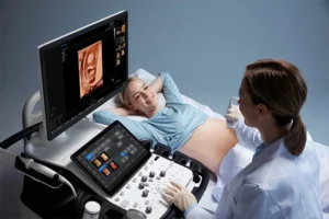 4D ultrasound from Samsung
